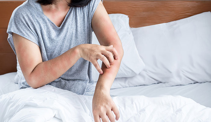Person scratching irritated arms